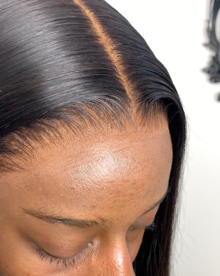 Frontal Installation Masterclass